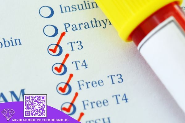 Pruebas de Sangre para el Diagnóstico de Hashimoto